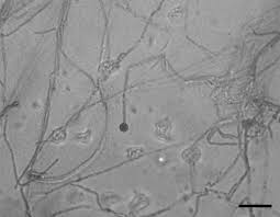 Attēlu rezultāti vaicājumam “Oxyporus corticola”