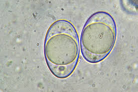 Attēlu rezultāti vaicājumam “Octospora humosa”
