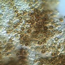 Attēlu rezultāti vaicājumam “Chaenotheca brunneola”