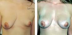 http://t0.gstatic.com/images?q=tbn:ANd9GcSdzI0UB1dNbE4mHb-wA1QDi6iIUIpCcj7V_mQZiENgDo79QT9dGoT2Tmc