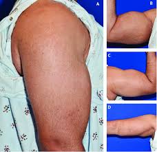 Image result for SYNTHOL