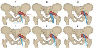 Attēlu rezultāti vaicājumam “Cribraria piriformis”