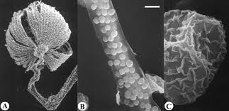 Attēlu rezultāti vaicājumam “Cribraria oregana spores”