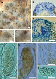 Attēlu rezultāti vaicājumam “Plectocarpon lichenum”