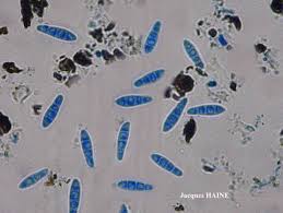Attēlu rezultāti vaicājumam “Opegrapha atra”