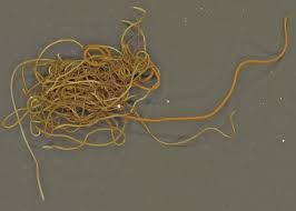 Attēlu rezultāti vaicājumam “Nematomorpha”