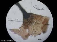 Attēlu rezultāti vaicājumam “Arcyria affinis capillitium”