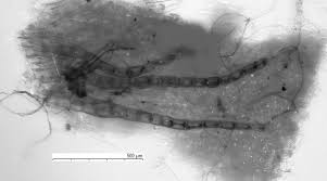 Attēlu rezultāti vaicājumam “Barbilophozia barbata”