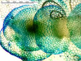 Attēlu rezultāti vaicājumam “Calypogeia neesiana”