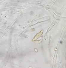 Attēlu rezultāti vaicājumam “Neocudoniella albiceps”