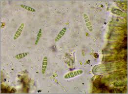 Attēlu rezultāti vaicājumam “Alyxoria varia”