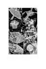 Attēlu rezultāti vaicājumam “Cribraria costata spores”