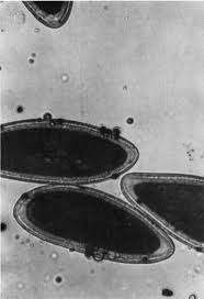 Attēlu rezultāti vaicājumam “Physarum obscurum spores”