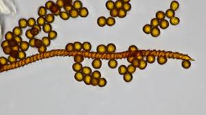 Attēlu rezultāti vaicājumam “Oligonema affine spores”