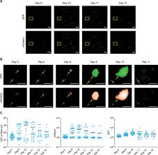 Attēlu rezultāti vaicājumam “Siphoptychium violaceum plasmodium”