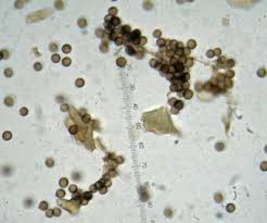 Attēlu rezultāti vaicājumam “Badhamia macrocarpa”