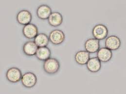 Attēlu rezultāti vaicājumam “Crepidotus applanatus”