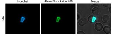 Attēlu rezultāti vaicājumam “Enteridium olivaceum plasmodium”