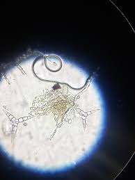 Attēlu rezultāti vaicājumam “Ophiostoma polyporicola”