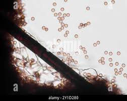 Attēlu rezultāti vaicājumam “Stemonitis marjana spores”