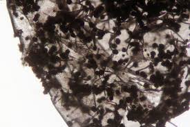 Attēlu rezultāti vaicājumam “Badhamia capsulifera”