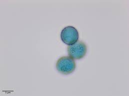 Attēlu rezultāti vaicājumam “Physarum, Nannengaella sp.”