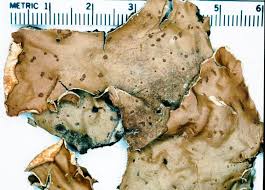 Attēlu rezultāti vaicājumam “Peltigera aphthosa”