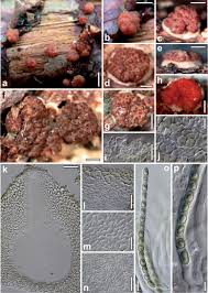 Attēlu rezultāti vaicājumam “Heterotrichia oerstedii (syn. Arcyria oerstedii) spores”