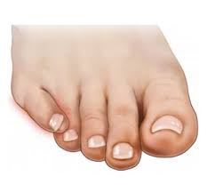 Znalezione obrazy dla zapytania palec