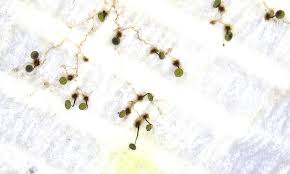 Attēlu rezultāti vaicājumam “Physarum penetrale stalked”