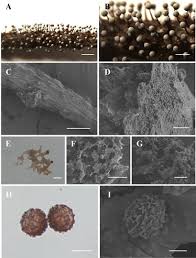 Attēlu rezultāti vaicājumam “Diachea muscorum spores”