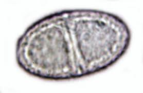 Attēlu rezultāti vaicājumam “Acrocordia gemmata”