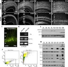 Attēlu rezultāti vaicājumam “Dianema depressum macro”