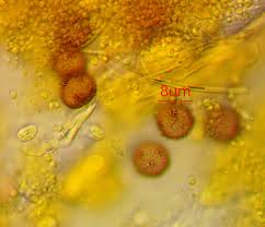 Attēlu rezultāti vaicājumam “Physarum bryomacrocarpum spores”