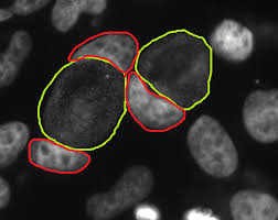 Attēlu rezultāti vaicājumam “Pseudobryum cinclidioides cells”