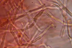 Attēlu rezultāti vaicājumam “Sidera lenis”