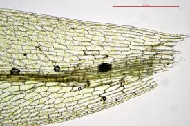 Attēlu rezultāti vaicājumam “Splachnum ampullaceum sporophyte”