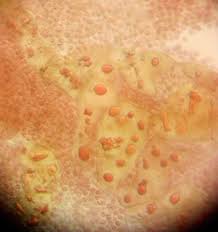 Attēlu rezultāti vaicājumam “Lycogala ustulatum macro”