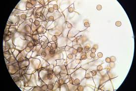 Attēlu rezultāti vaicājumam “Collaria arcyrionema spores”