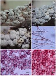 Attēlu rezultāti vaicājumam “Oligonema favogineum spores”