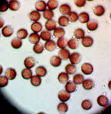 Attēlu rezultāti vaicājumam “Physarum pseudoalexandrowiczii”