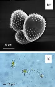 Attēlu rezultāti vaicājumam “Melampsora magnusiana”