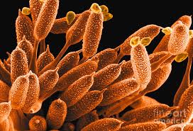 Attēlu rezultāti vaicājumam “Phragmidium sp.”