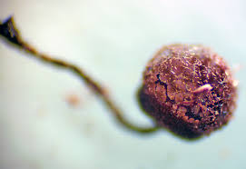 Attēlu rezultāti vaicājumam “Lycogala ustulatum macro”