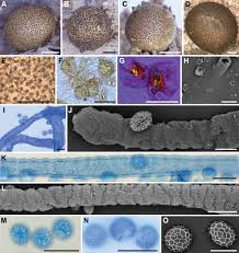 Attēlu rezultāti vaicājumam “Lycogala sp.”