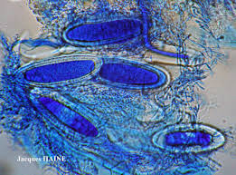 Attēlu rezultāti vaicājumam “Pertusaria pertusa”