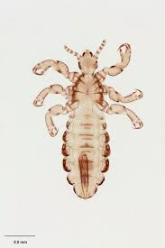 Attēlu rezultāti vaicājumam “Pediculus humanus capitis”