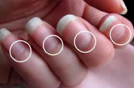 Image result for lunula nail