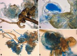 Attēlu rezultāti vaicājumam “Octosporella jungermanniarum”