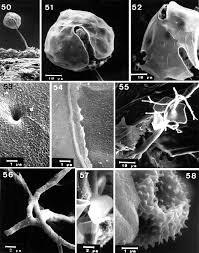 Attēlu rezultāti vaicājumam “Badhamiopsis ainoae spores”